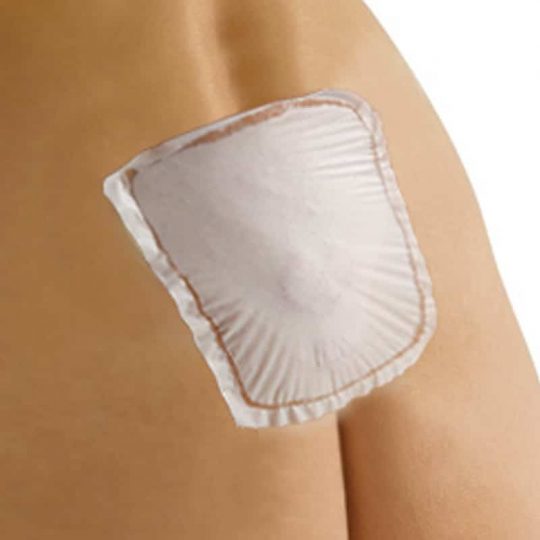 Quel coussin pour un kyste pilonidal ? – Le kyste sacro-coccygien